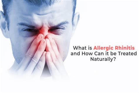 What Is Allergic Rhinitis And How Can It Be Treated Naturally Jindal