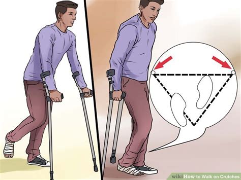 How To Walk On Crutches How To Do It