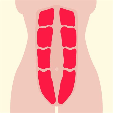 Diastasis Recti What It Is And How To Treat It Bellabeat
