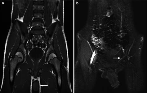 Principles Of Magnetic Resonance Imaging Mri Radiology Key