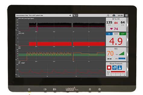 How To Guides Lidco Hemodynamic Monitoring For The Entire Patient