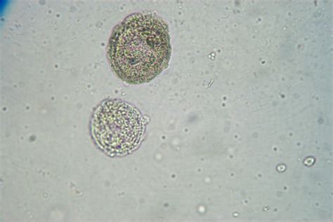 8 White Blood Cells In Urine Pictures Biological Science Picture