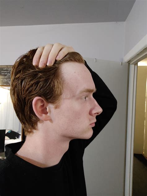 Remarkable Photos Of I Have A Big Forehead Concept Hairstyles