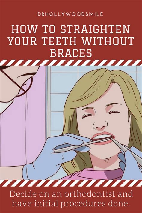 Metal braces have long been considered the traditional approach to a straight smile, and the stainless steel design makes them strong and robust. How to Straighten Your Teeth Without Braces (With images ...