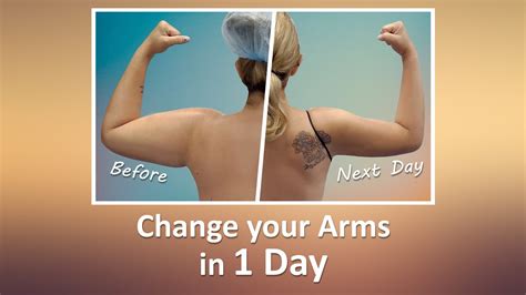 Celebrity Arms Lipo Arms Immediate Results High Definition