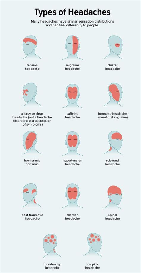 Types Of Headaches MEDizzy