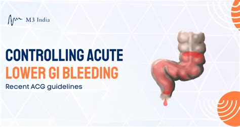 Lower Gi Bleeding Management Summary Of Acg Guideline