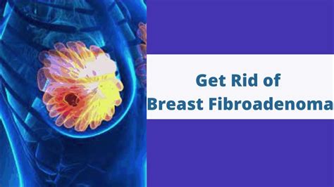 Breast Fibroadenoma Treatment Without Surgery In Hyderabad Vabb
