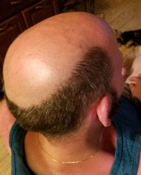 Pinterest Bald Men Style Male Pattern Baldness Punishment Haircut