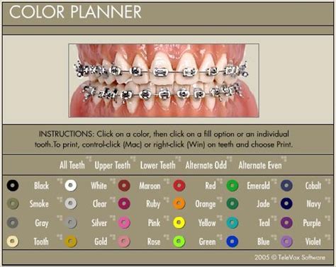 Band Color Chooser | Braces | Pinterest | Colors and Band