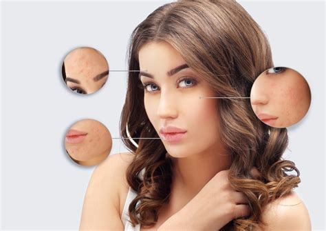 Acne Scar Treatment Premier Cosmetic Surgery And Medspa