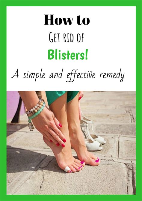 How To Get Rid Of Blisters With A Simple And Effective Remedy