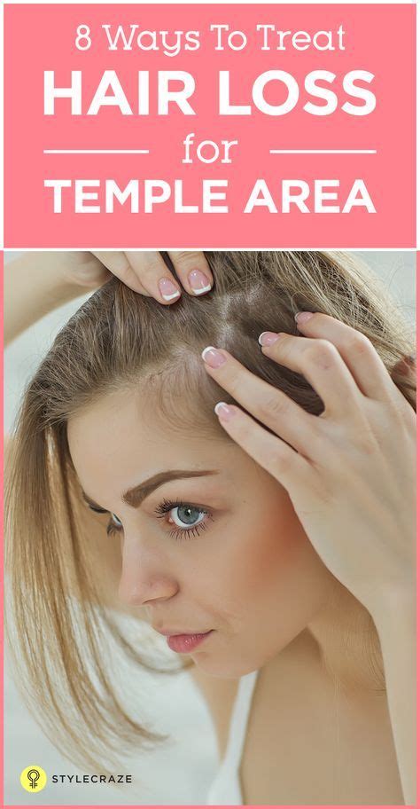 The most important thing you can do today, is begin on a treatment regimen. 8 Simple Ways To Treat Hair Loss At The Temples | Temple ...