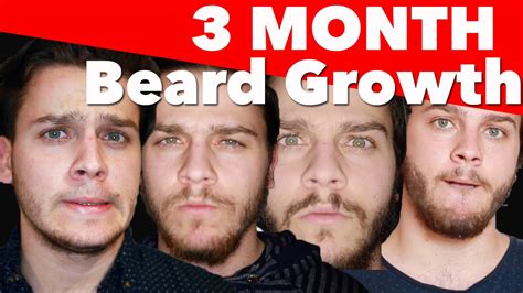 Types Of Beard Growth
