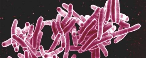 Tuberculosis, or tb, is a bacterial infection that usually infects the lungs. Surgen nuevos medicamentos para tratar la tuberculosis ...