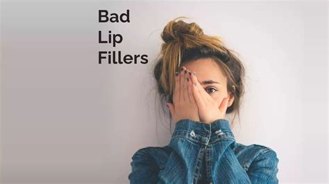 Bad Lip Fillers 1celebrities Experience Easy Peasy Skincare