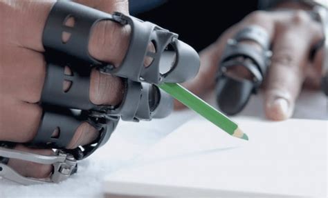 advancements to explore innovative prosthetics technology