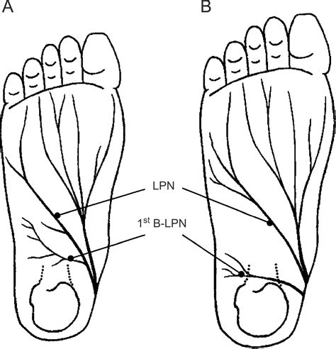 A Review Of Plantar Heel Pain Of Neural Origin Differential Diagnosis