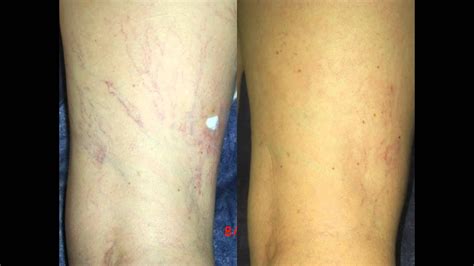 Simple Science: How to Make a Volcano with Kids