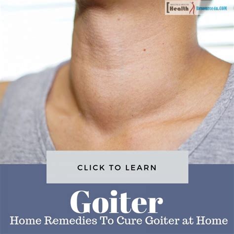 Home Remedies To Cure Goiter At Home Its Causes And Symptoms