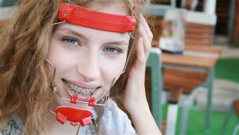 orthodontic headgear in parker and castle rock co 20 mile orthodontics