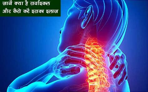 Cervical Pain In Hindi सर्वाइकल का कारण इलाज घरेलू उपचार और परहेज़