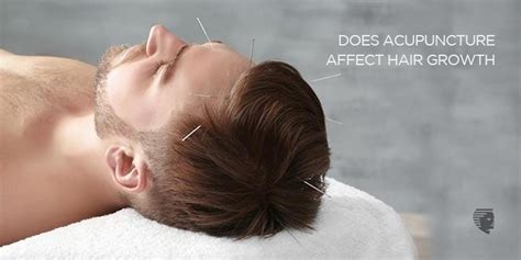 Acupuncture has been found to be particularly effective for those suffering from hair loss as a result of hormonal imbalances (especially women with an overabundance of male hormones), stress and nutritional deficiencies. Can Acupuncture Really Affect Hair Growth? - AHS India