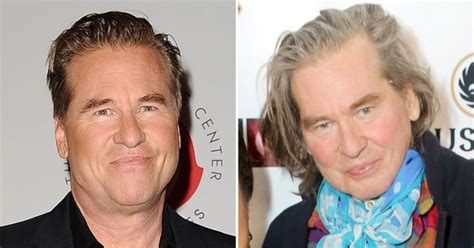 What throat cancer look like. Val Kilmer looks healthy at art exhibition after throat ...