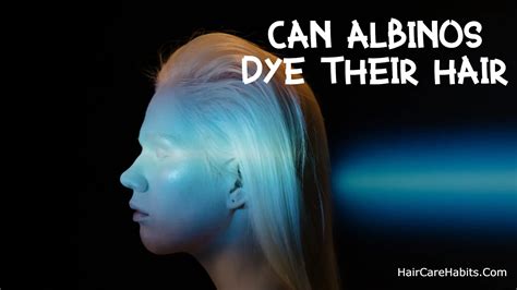 Can Albinos Dye Their Hair Full Detail 2024 Hair Care Habits