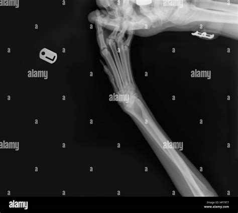 Skeleton Leg And Foot Hi Res Stock Photography And Images Alamy