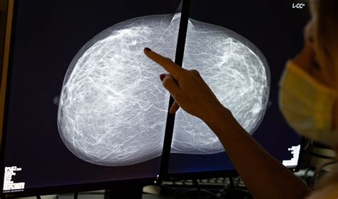 Ai Can Detect Breast Cancer As Well As Radiologists Study Finds The