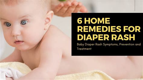 6 Home Remedies For Diaper Rash In Babies Baby Diaper Rash Symptoms