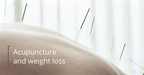 Acupuncture For Weight Loss Does It Work