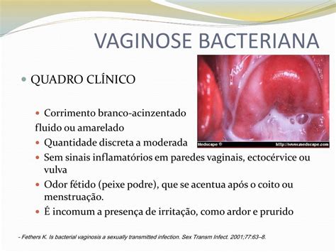 PPT VULVOVAGINITES PowerPoint Presentation Free Download ID