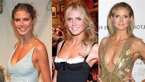 Heidi Klum Plastic Surgery Before And After Pictures 2018