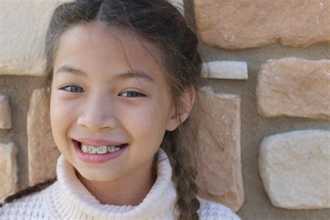 the pros and cons of different types of braces thurman orthodontics