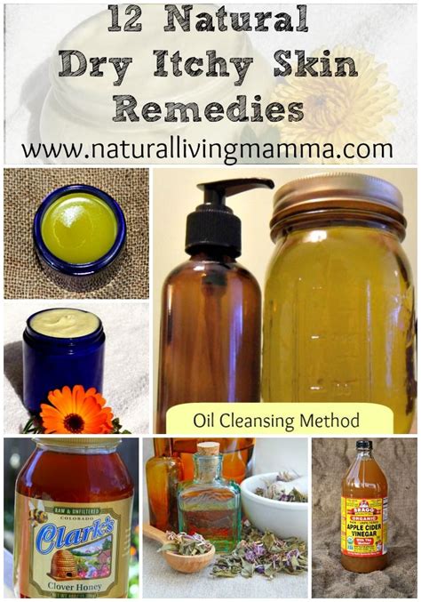 12 Natural Dry Itchy Skin Remedies Natural Living Mamma Natural