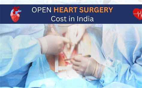 Open Heart Surgery Cost In India Wellness Hospitals