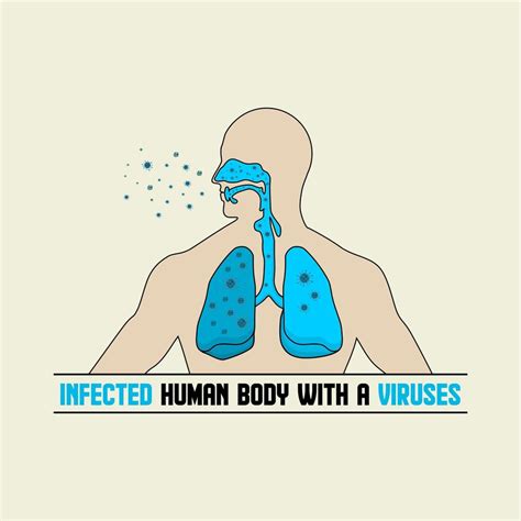 Infected Human Respiratory Tract Illustration 833593 Vector Art At Vecteezy