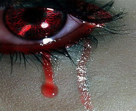 Sad Blood Tears In Eyes