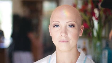 Alopecia Beauty Photos Trends And News Page 2 Allure