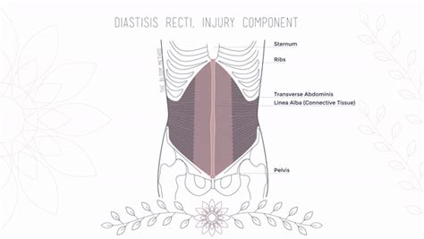 The Difference Between Abdominal Separation And Diastasis — The Bloom