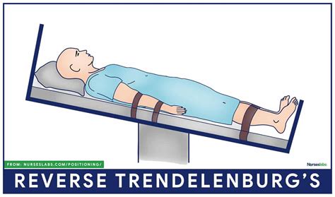 Reverse Trendelenburg Position Definition