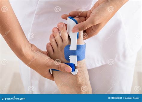 Orthopedist Fixing Plaster On Injured Man`s Foot Stock Image Image Of