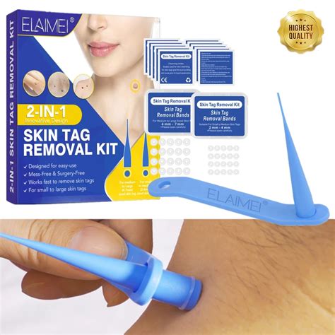 in wart remover skin tag removal kit wart tag cure remover device rubber bands micro band face