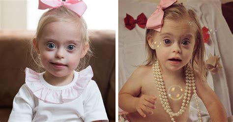 2 Year Old Girl With Down Syndrome Wins Two Modelling Contracts Thanks To Her Cheeky Smile