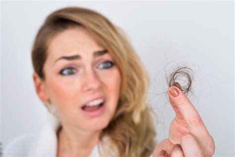 Hair Loss And Its Types Hair Loss Type