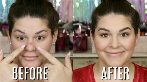 How To Cover Up Pimples Like A Pro Full Coverage Acne Foundation