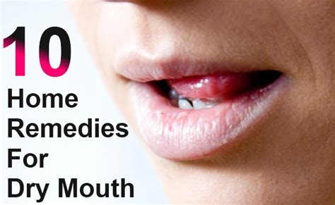 10 Very Effective Home Remedies For Dry Mouth Morpheme Remedies India