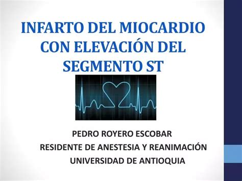 PPT INFARTO DEL MIOCARDIO CON ELEVACIÓN DEL SEGMENTO ST PowerPoint Presentation ID